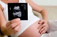 УЗИ во время беременности. Фото с сайта www.sciencephoto.com