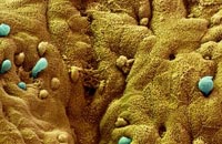Амебиаз (Амебная дизентерия). Амебы на стенке толстой кишки. Фото с сайта www.sciencephoto.com