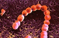 Ревматизм. Стрептококк А. Фото с сайта www.sciencephoto.com