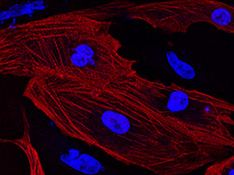 Кардиомиоциты под конфокальным микроскопом. Фото с сайта futura-sciences.com