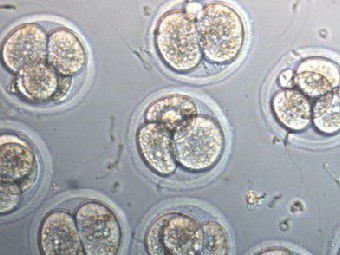 Эмбрионы, полученные в результате ЭКО. Фото с сайта hamiltonthorne.com 