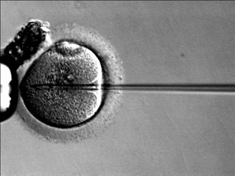 Инъекция сперматозоида в ооцит при процедуре ИКСИ. Иллюстрация с сайта commons.wikimedia.org