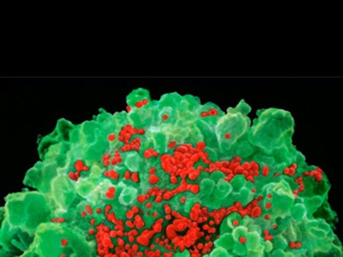 Вирусы иммунодефицита (красный цвет) на поверхности клетки. Иллюстрация с сайта microbiologyonline.org.uk