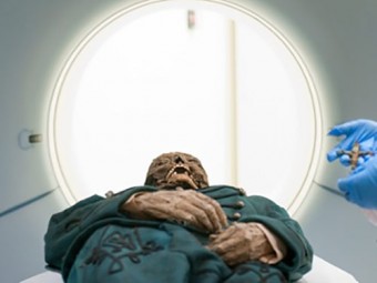 Венгерские мумии помогли уточнить сроки эпидемий туберкулеза 