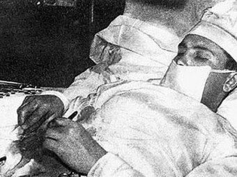 54 года назад Леонид Рогозов удалил себе аппендицит