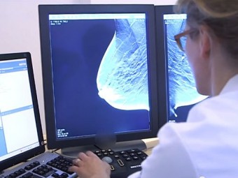 3D-скрининг рака груди обнаруживает заболевание на 40% чаще