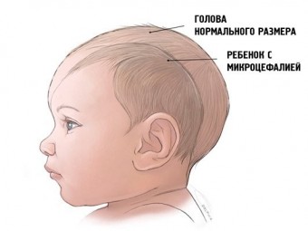 В ВОЗ считают, что Бразилия сможет обезопасить гостей ОИ от вируса Зика