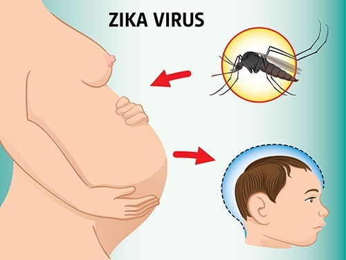 Последствия заражения вирусом Зика могут быть серьезнее, чем думали — ВОЗ
