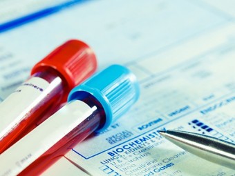 Разработан тест для диагностики туберкулеза