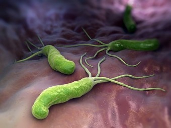 ,   :    Helicobacter pylori