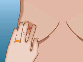 Изображение с сайта breastcancer.about.com