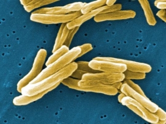 смертность от туберкулеза